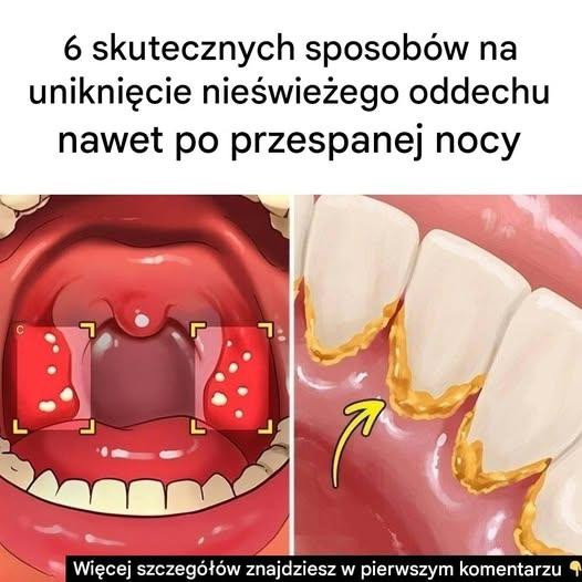 6 sposobów na uniknięcie nieświeżego oddechu