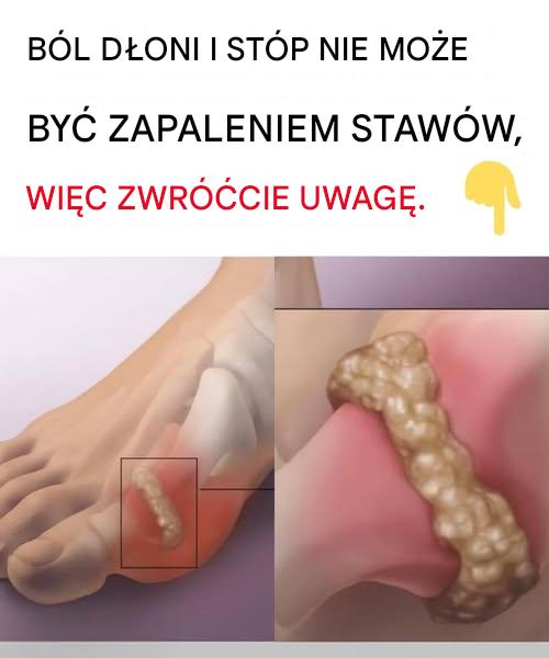 Wyeliminuj kryształy kwasu moczowego ze stawów dzięki temu prostemu sposobowi na bazie ogórka
