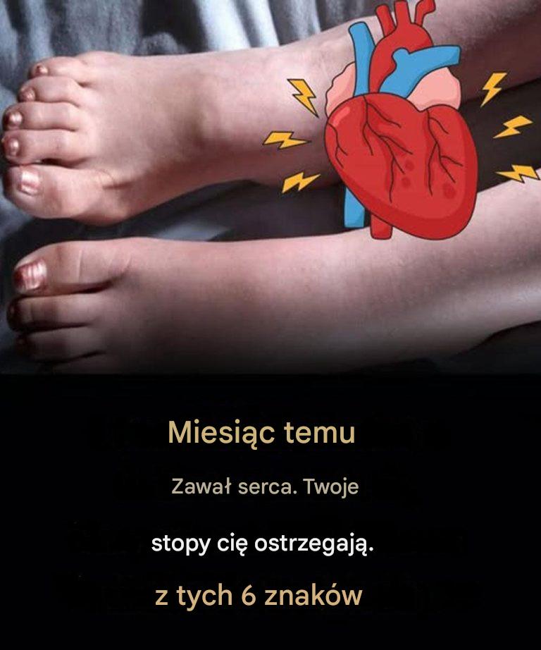 Teraz możesz usłyszeć około 6 sygnałów.