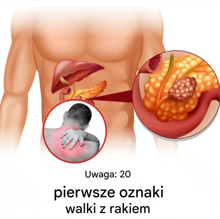 20 wczesnych sygnałów ostrzegawczych, jeśli Twój organizm walczy z malatią